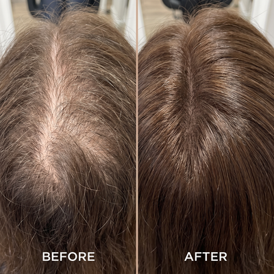 Stop Hiding Your Scalp. Bring Back The Look Of Fuller Hair.